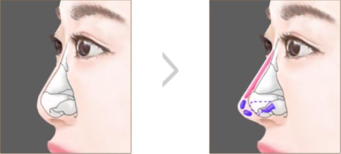 西安整形美容醫(yī)院推薦top4大揭秘！從西美到時(shí)光，最佳選擇一覽無余！