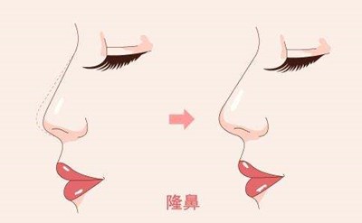 寧夏蛋白短線收緊面部醫(yī)生