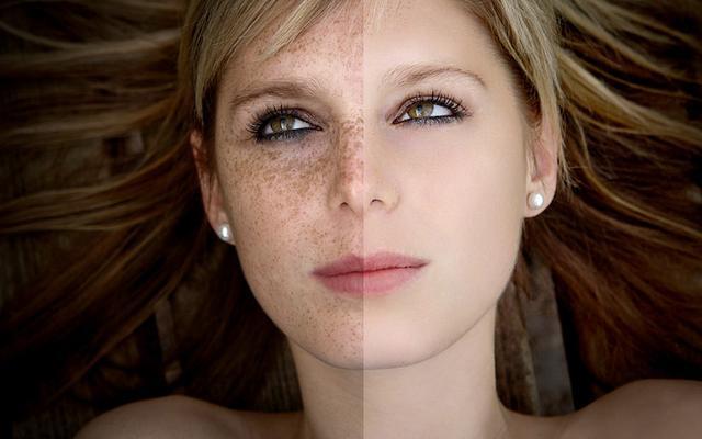 寧波墊鼻根醫(yī)生