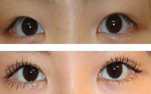 衡陽五家頂尖激光祛斑整形醫(yī)院匯總！療效質(zhì)優(yōu)，廣受好評！