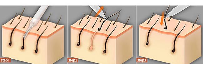 福州祛痣醫(yī)院推薦！快速了解前八家信譽口碑醫(yī)院