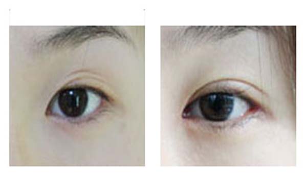 熱瑪吉整形醫(yī)院最受好評(píng)的六個(gè)機(jī)構(gòu)合集！尋找這些隱藏的寶藏醫(yī)院，分享給你，讓你重拾自信！