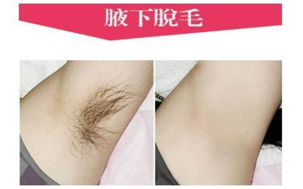 聚焦常州激光醫(yī)院效果盤點(diǎn)：美麗年輕無(wú)止境！