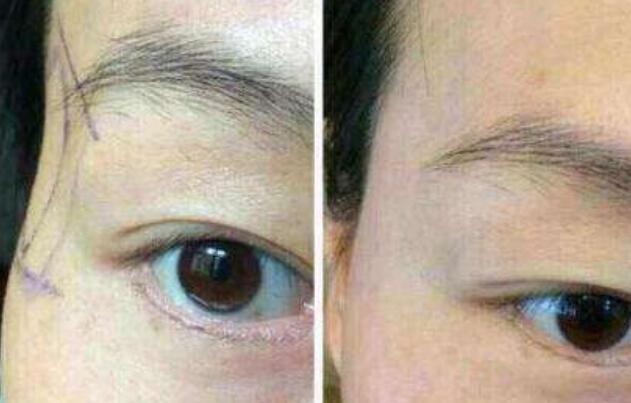 青島市祛斑醫(yī)院對比排行榜：公立私立均有上榜，詳盡評估剖析