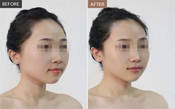 黃石市最好的雙眼皮醫(yī)院推薦TOP5，公私醫(yī)院評(píng)價(jià)大揭秘