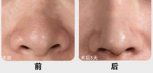 廈門市有哪些醫(yī)院提供優(yōu)質(zhì)的脂肪填充服務(wù)？江頭醫(yī)院、臉康整形醫(yī)院、美麗醫(yī)療中心等值得一看！快來了解一下