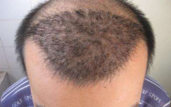 長(zhǎng)春三家牙齒整形醫(yī)院推薦：白求恩、段氏、華植等音譽(yù)卓著