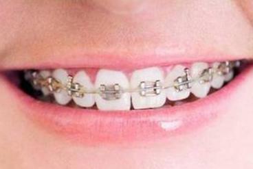 重慶激光洗紋身整形醫(yī)院聚焦盛夏排行榜，單品強力推薦！