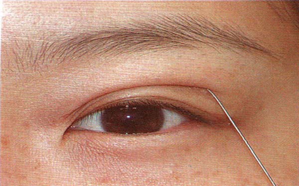 長沙五家醫(yī)院哪家提供優(yōu)質(zhì)吸脂技術(shù)？推薦專業(yè)減重能手！