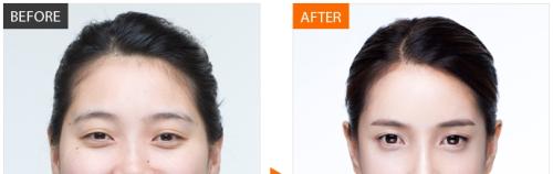 重慶最佳口腔?？漆t(yī)院排名公布！附牙齒矯正快速詢價攻略