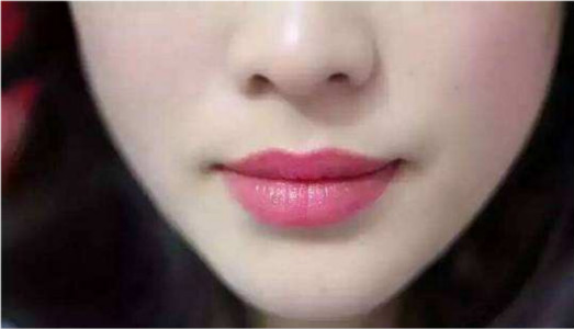 阜陽(yáng)腹部除皺醫(yī)生