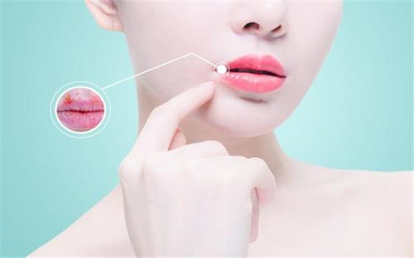 長沙腿部做吸脂醫(yī)生