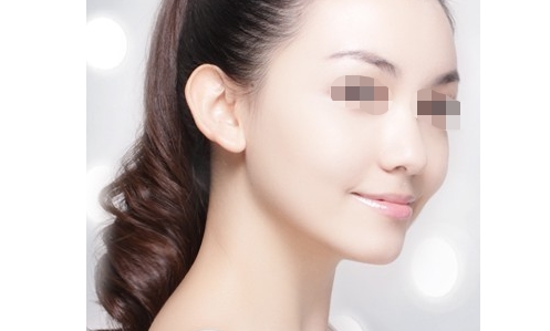 寧波d女郎豐胸醫(yī)生