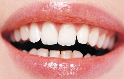 2023年武漢市性價(jià)比高的面部提拉微整形美容醫(yī)院排行榜TOP10！