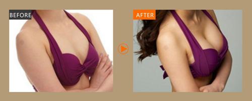 常德注射填充法令紋醫(yī)生