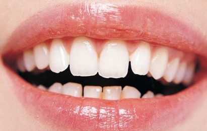 2023年，哪家醫(yī)院在武漢提供高質(zhì)量的無痕隆胸手術(shù)？