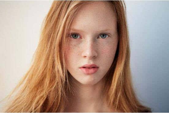 深圳微晶無創(chuàng)溶斑醫(yī)生