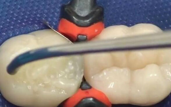 寧波下巴玻尿酸注射：2023年醫(yī)術(shù)精湛的醫(yī)院排行榜公布，這些整形醫(yī)院備受推崇！