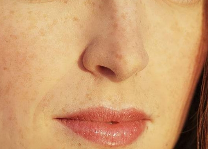 寧波抽脂手術(shù)減肥醫(yī)生