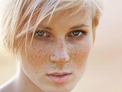 合肥下眼瞼拉皮醫(yī)生