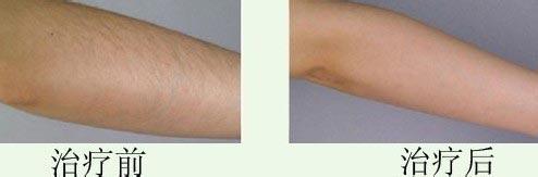 連云港哪些整形美容醫(yī)院在2023年在玻尿酸頸紋填充方面有口碑？十大排名新鮮出爐！