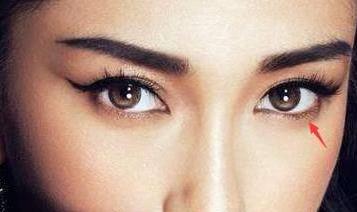 溫嶺小腿溶脂減肥醫(yī)生