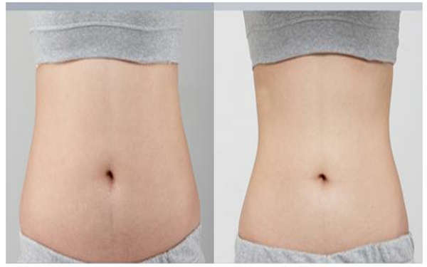 2023年貴陽哪家雙眼皮整形醫(yī)院口碑，排名前10強(qiáng)整容美容醫(yī)院全揭秘