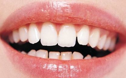 西安去頸部皺紋哪家醫(yī)院靠譜？2023西安提拉去頸部皺紋醫(yī)院十強榜單揭曉！