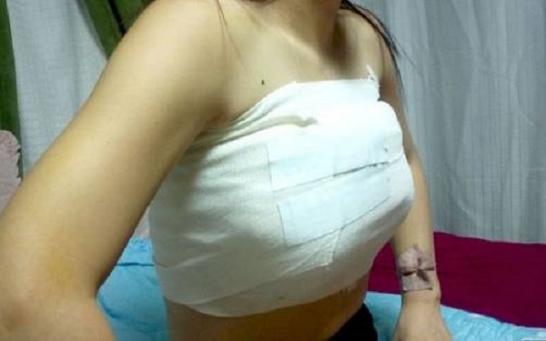 鄭州哪家整形醫(yī)院能讓您擁有完美豐唇？2023年排名前十的鄭州豐唇整形醫(yī)院是哪些？