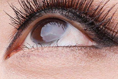 2023廣州肉毒素注射川字紋整形醫(yī)院排行榜公布！這些醫(yī)療美容機(jī)構(gòu)備受矚目！