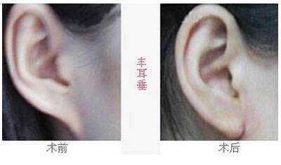 2023沈陽去魚尾紋雕塑醫(yī)院排行榜，這十家都備受口碑推崇！