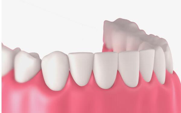 哪家南京整形醫(yī)院在川字紋脂肪填充方面效果突出？2023南京脂肪填充川字紋醫(yī)療前十強(qiáng)排行榜權(quán)威推薦！