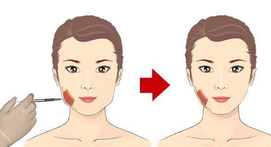 2023烏魯木齊去黑眼圈整形醫(yī)院排行榜揭曉！高性?xún)r(jià)比的醫(yī)院有哪些？