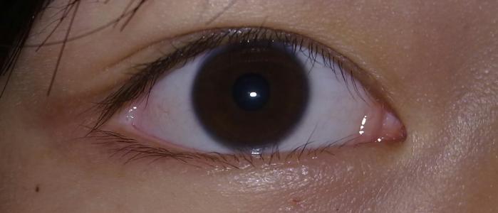 2023年浙江哪些醫(yī)院是值得去的提拉去眉間紋醫(yī)療美容醫(yī)院排名榜前十強(qiáng)詳解，實(shí)力解析！