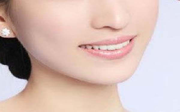 河北注射玻尿酸去靜態(tài)紋醫(yī)生