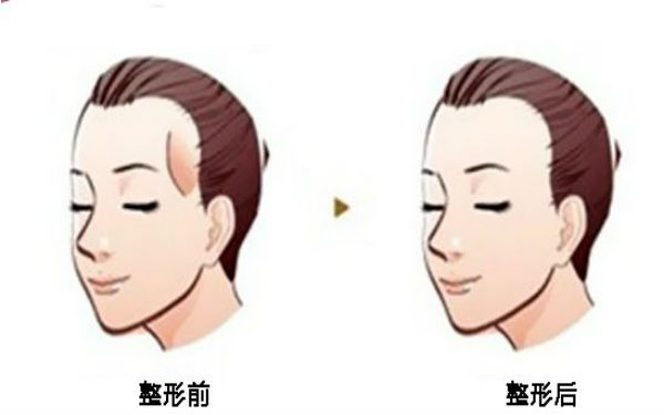 西寧顴骨矯正術(shù)：哪家醫(yī)院口碑好？2023年口碑排名前10的正規(guī)醫(yī)療整形醫(yī)院公布！