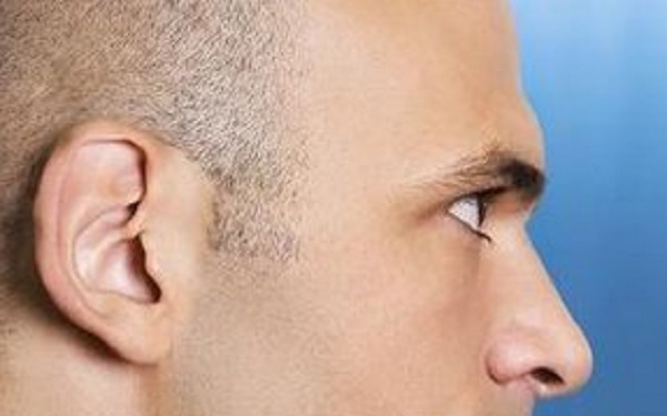 深圳哪幾家醫(yī)院能有效去除眼紋？2023年深圳比較好的眼紋去除醫(yī)院排名前十位解析！