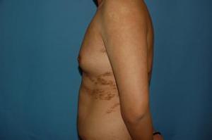 濟寧哪家醫(yī)院玻尿酸填充手術(shù)技術(shù)專業(yè)？2023年榜單首席整形醫(yī)院揭曉！