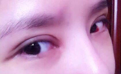 北京注射填充豐鼻唇溝醫(yī)生