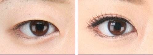 【2023成都光波去雀斑】Top10名單揭曉！讓你遠離雀斑煩惱，品質(zhì)醫(yī)美醫(yī)院推薦！