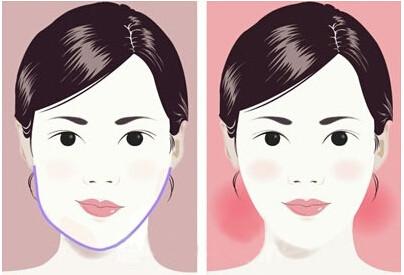 沈陽無痕除皺術：2023年，擁有卓越口碑的專業(yè)醫(yī)院排行榜前十揭曉！