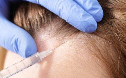 2023臺(tái)州祛除下眼皮皺紋排名前10的可靠整形醫(yī)院甄選