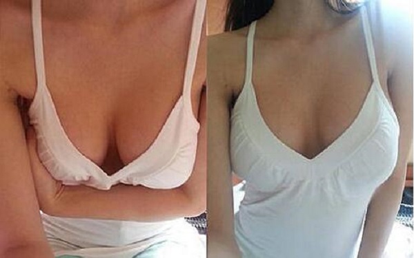 2023太原光子去咖啡斑治療醫(yī)院排行出爐！哪家醫(yī)院效果比較好