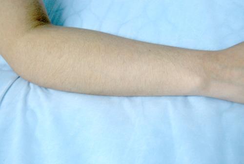 廣州哪些醫(yī)院是2023年權(quán)威整形手術(shù)榜單前10位？調(diào)查顯示選擇是哪家？