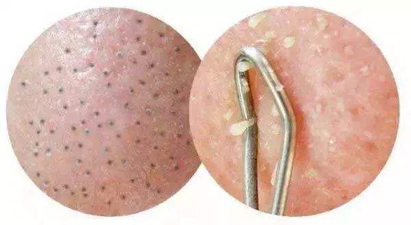 長春無痕動(dòng)態(tài)隆胸醫(yī)生