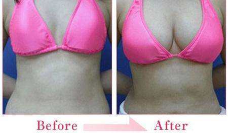 2023年哪些醫(yī)院是吉林非常受歡迎的臀部膠原蛋白填充整形美容機(jī)構(gòu)？