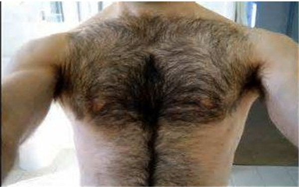 2023年寧波去唇紋排行前十強醫(yī)院推薦！比較正規(guī)的自體填充醫(yī)院有哪些？