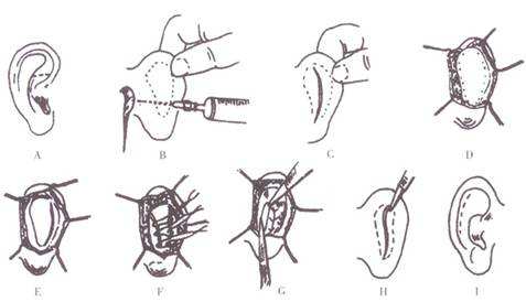 2023杭州細胞填充面部整形美容醫(yī)院排行榜公布！尋找最可靠的選擇