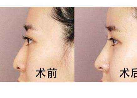 六安市受歡迎的雙眼皮整形美容醫(yī)院排行榜出爐！2023最值得信賴的明眸翹睫醫(yī)療機構(gòu)盤點！