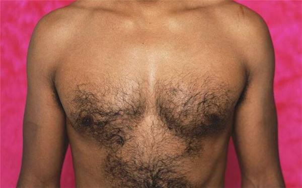 南昌去咬肌整形醫(yī)院有哪些值得去的？2023南昌瘦臉針去咬肌排行榜前10家醫(yī)院大變動！